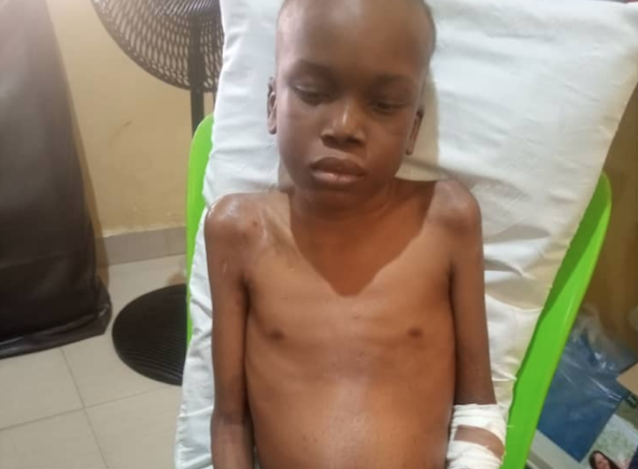 10-year-old Stroke Patient Desperately Needs N7m for Multiple Surgeries