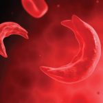 sicklecells-1-1536x864